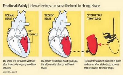 Broken Heart Syndrome - อาการของกลุ่มอาการ