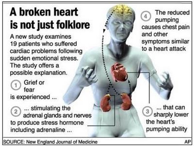 Broken Heart Syndrome - อาการของกลุ่มอาการ